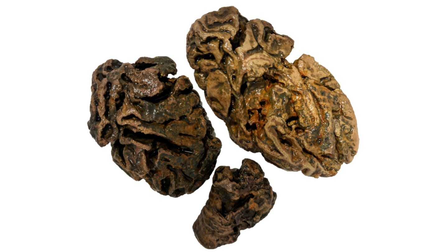 3 fragments of a preserved human brain on a white background