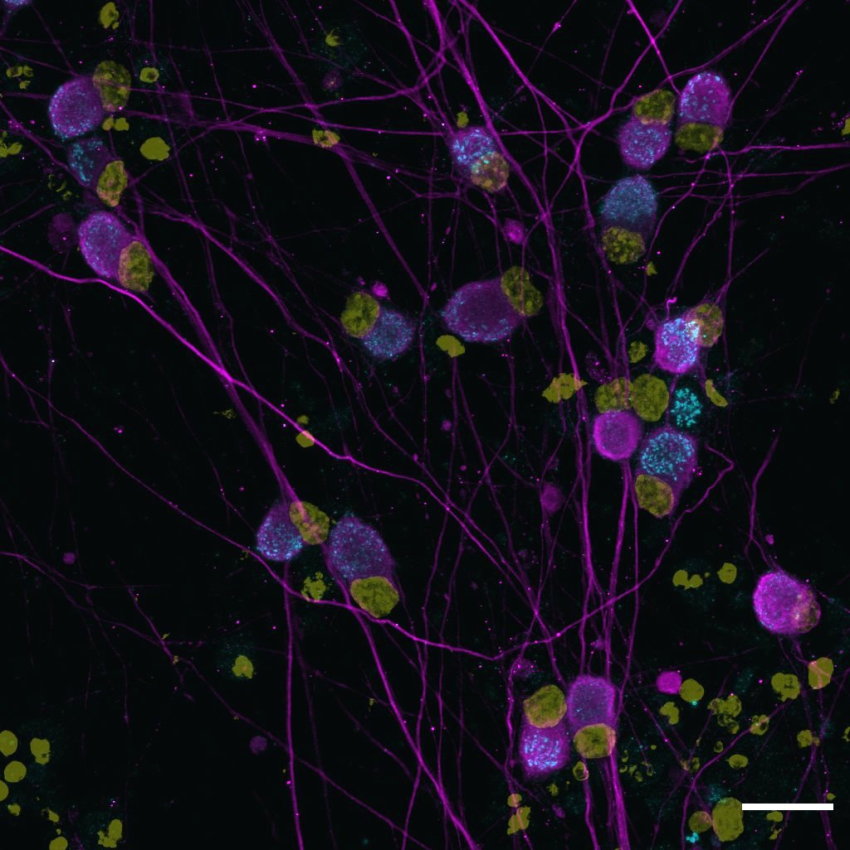 Microscope image of human sensory neurons with different components fluorescing different colours to visualise them