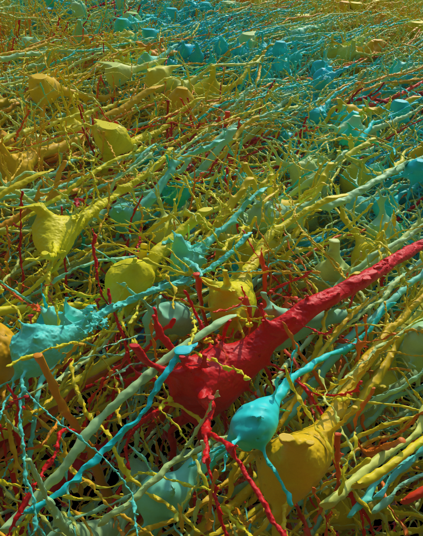 Computer generated image of human neurons in varying shades of yellow, blue, and red