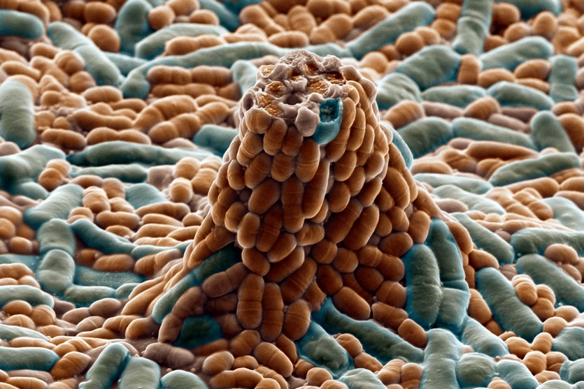 A scanning electron micrograph of Lactobacillus paracasei bacteria, a common probiotic that can protect against pathological intestinal flora. 