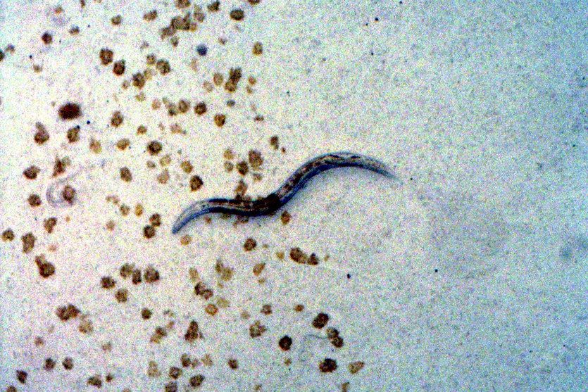 A c elegans roundworm.
