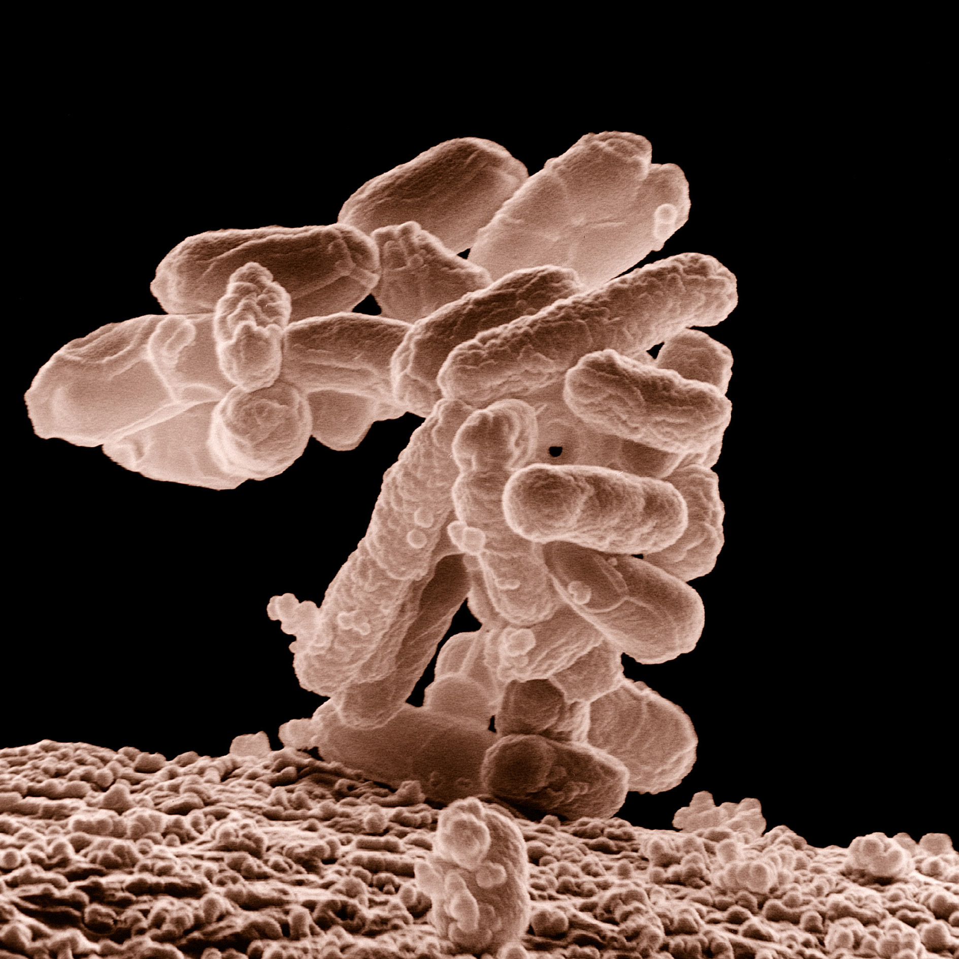 A colony of E. coli.