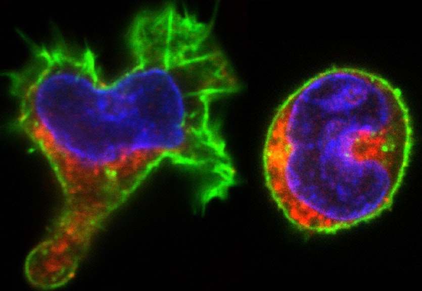 Confocal microscope image of two cells with different morphologies.