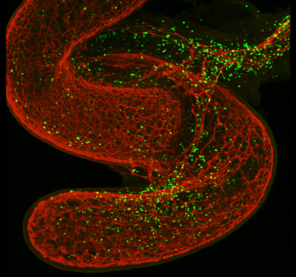 Innate lymphocytes (green) surround the gut (red).