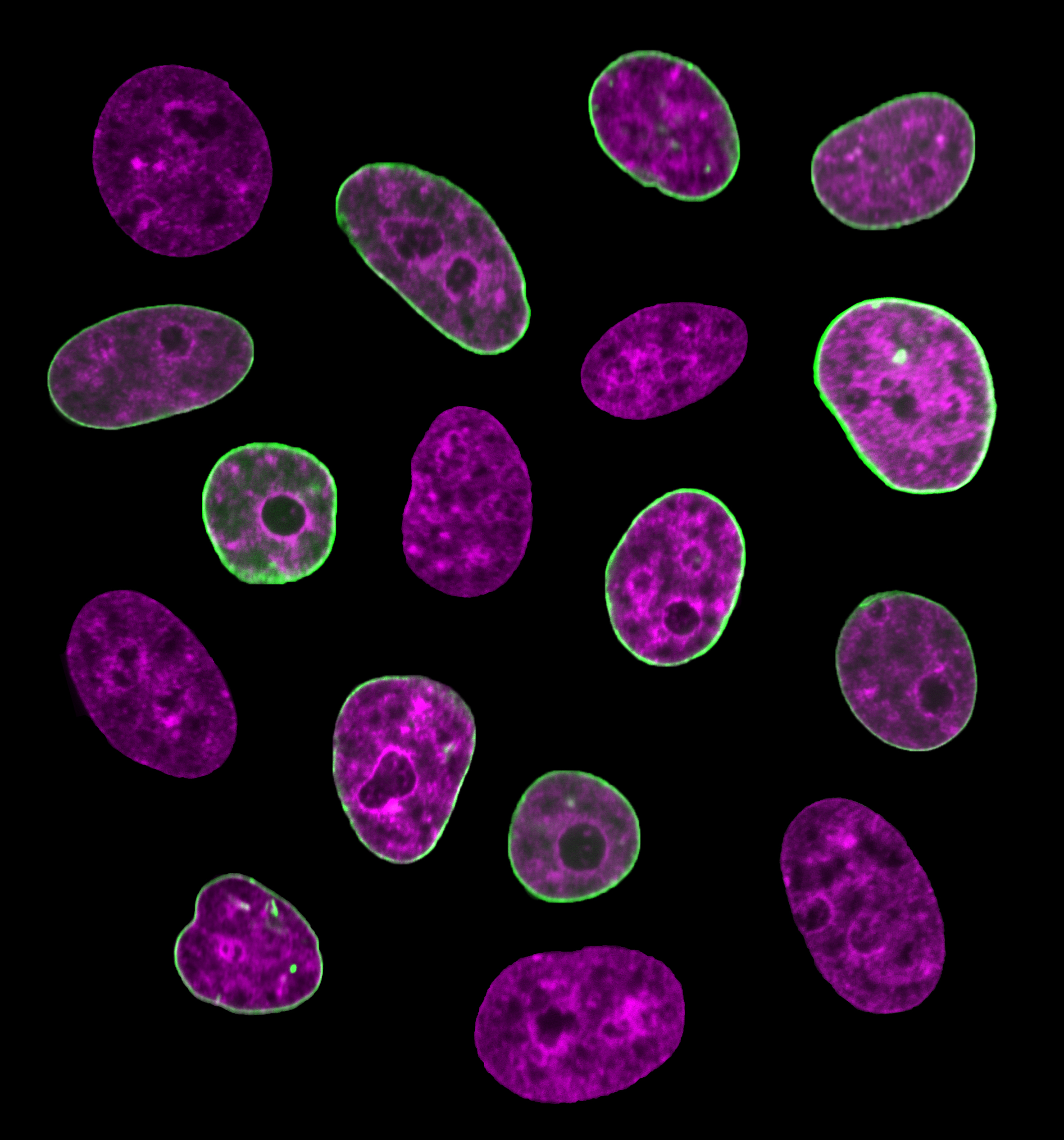 Human cell nuclei with fluorescently labeled chromatin (purple) and nuclear envelope (green).