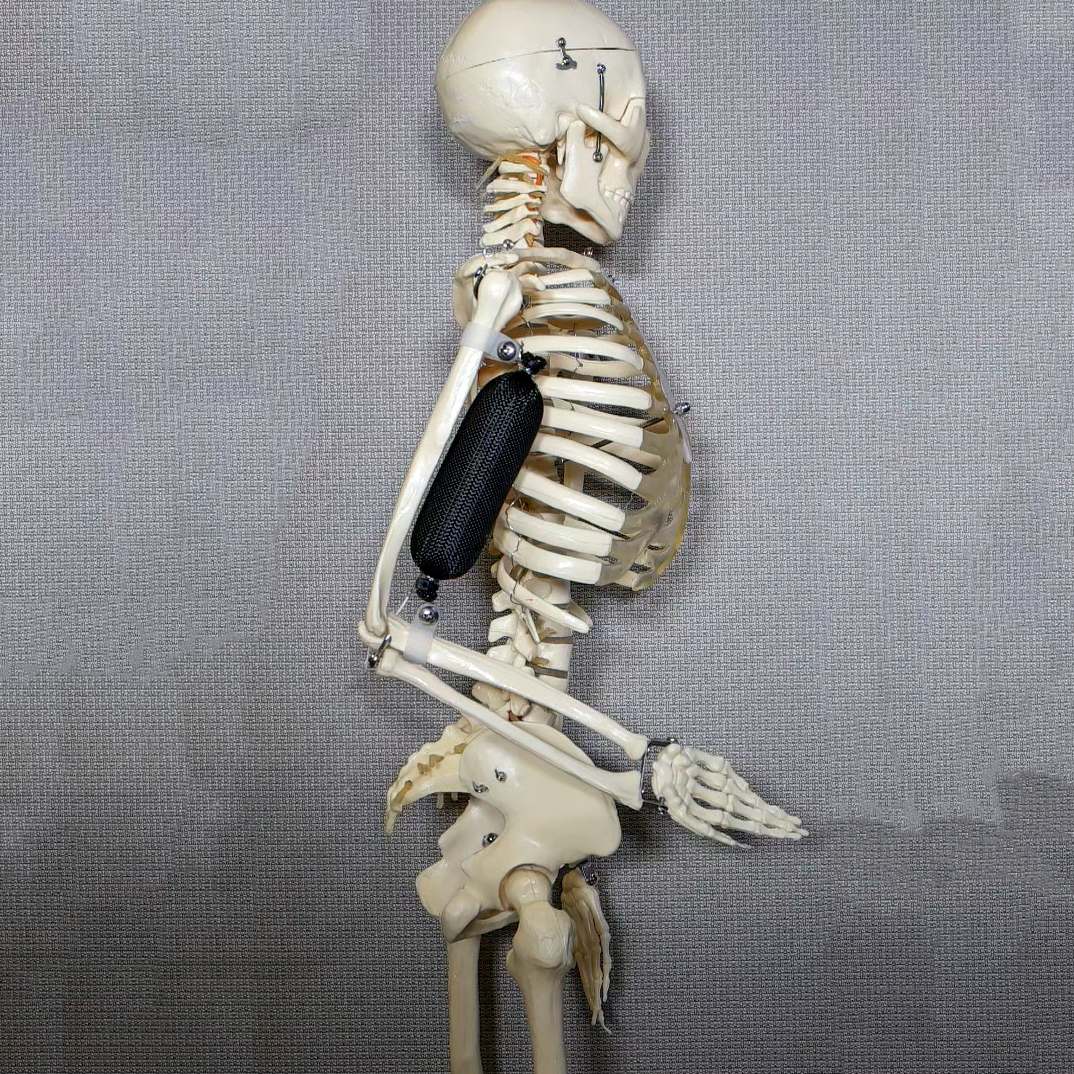 Skeleton with an artificial bicep.