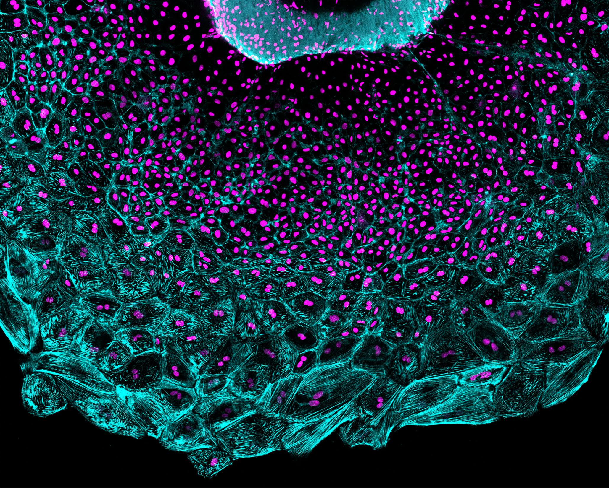 Regrowing cells in a zebrafish heart.