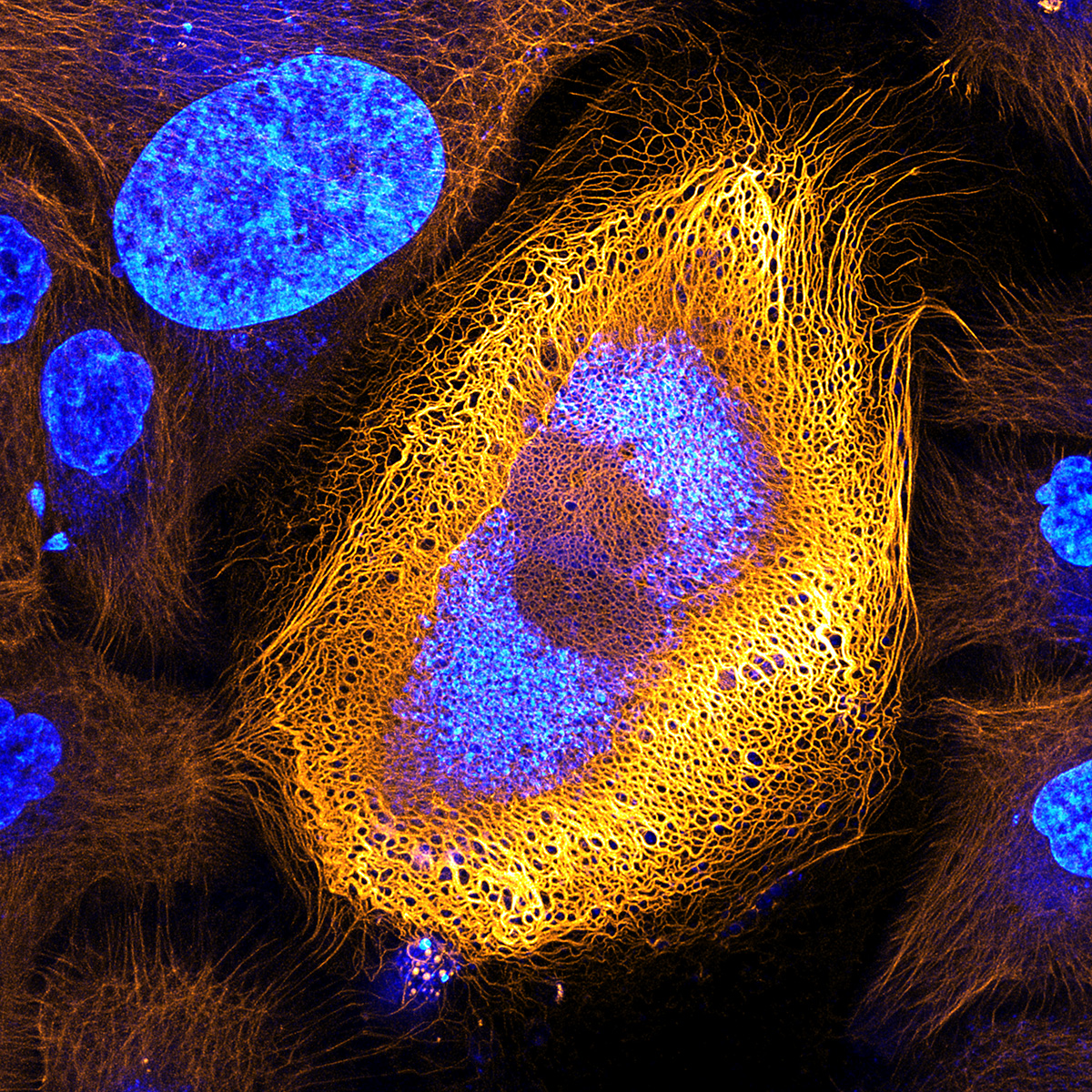 Human skin cells (HaCaT keratinocytes) expressing fluorescently tagged keratin.