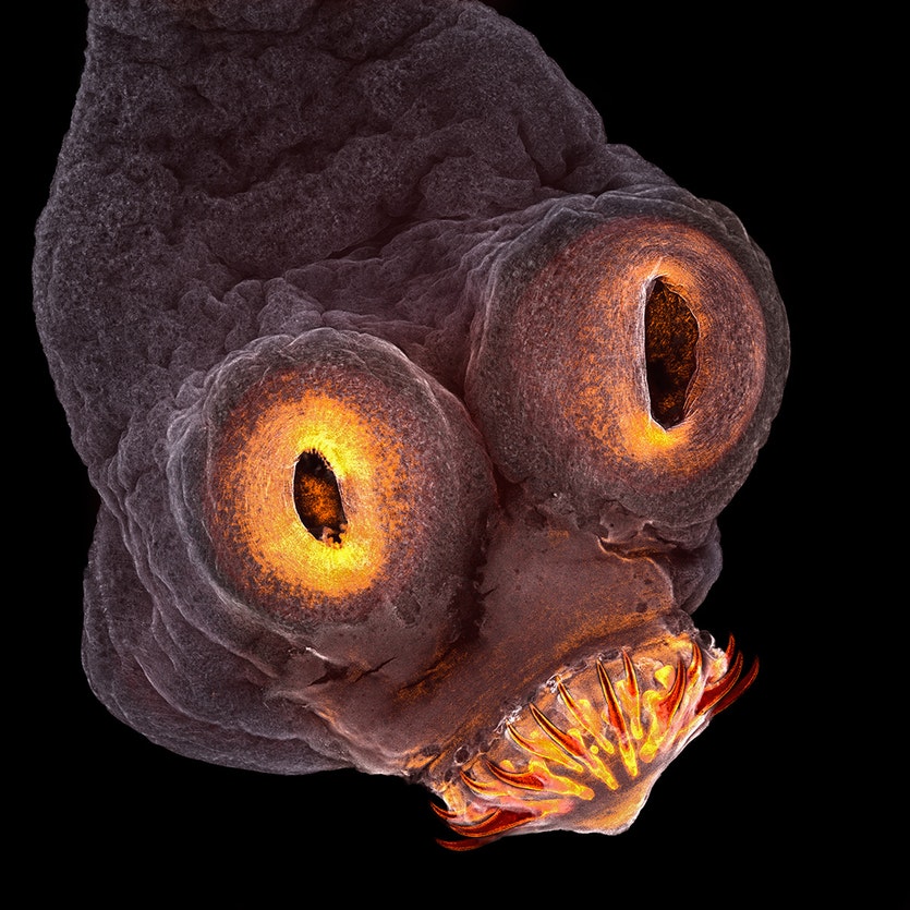 The everted scolex (head) of a pork tapeworm (Taenia solium).