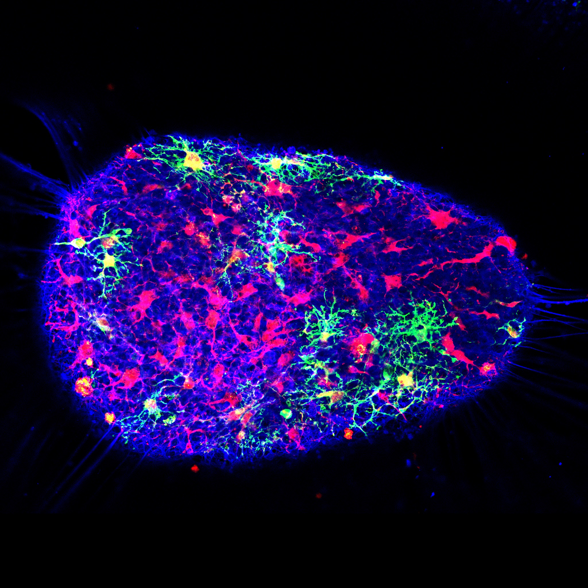 An ‘asteroid’ three-dimensional neural circuit generated from human stem cells.