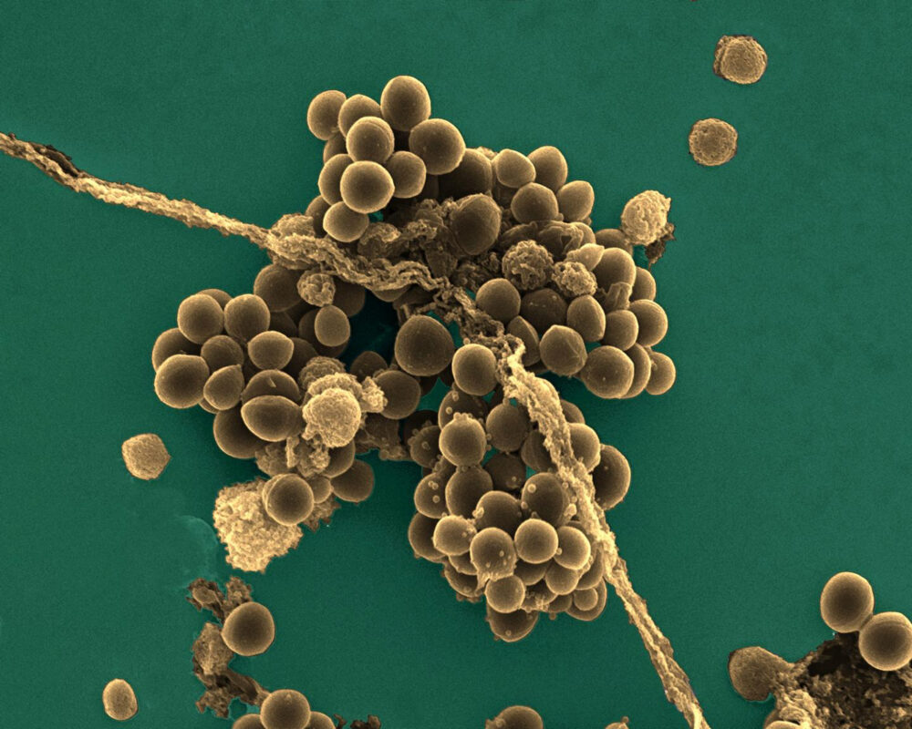 A scanning electron microscope image of Staphylococcus aureus (‘golden staph’) cells.
