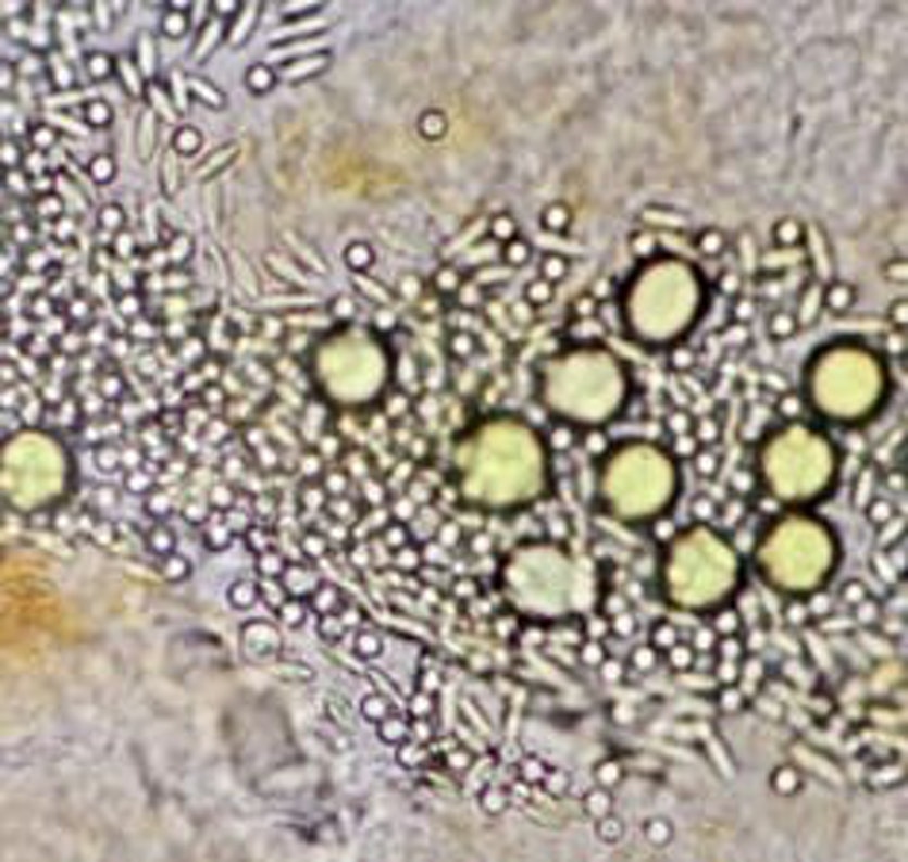 Particles of different size and shape (spherical and rod) from the dissected gut of a mucous-mesh grazer, the appendicularian Oikopleura dioica.