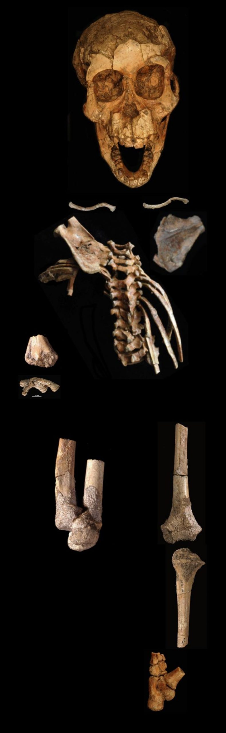 The Dikika foot is one part of a partial skeleton of a 3.32 million-year-old skeleton of an Australopithecus afarensis child.