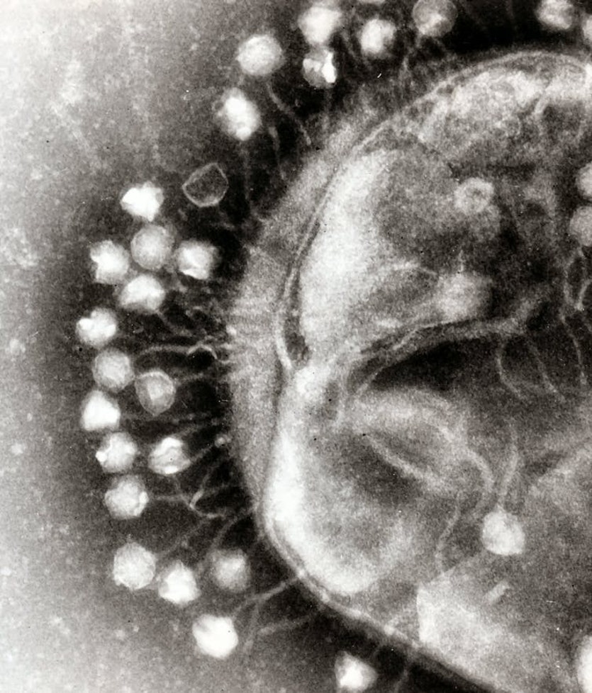 Electron micrograph image of bacteriophages attached to a bacterial cell.