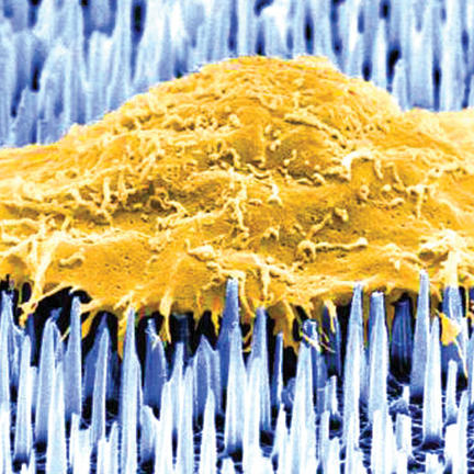 The image shows a single human cell (brown) on a bed of nanoneedles (blue). This image was taken by the researchers using electron microscopy.