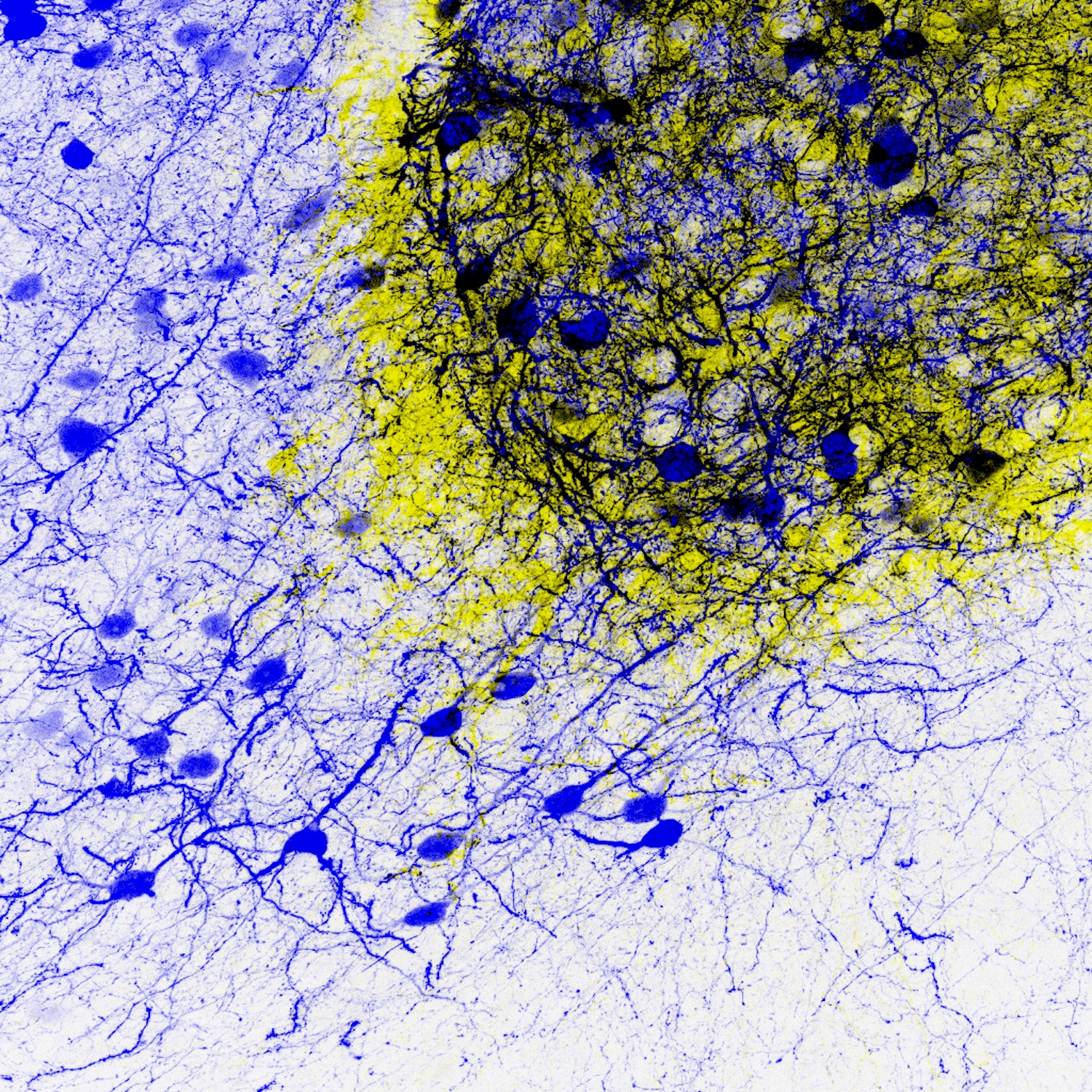 Transplanted Brain Cells Restore Circuitry In Adult Mice Cosmos Magazine