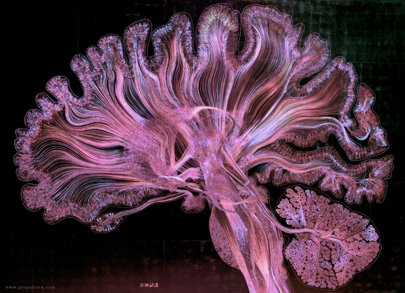 Brain 136745