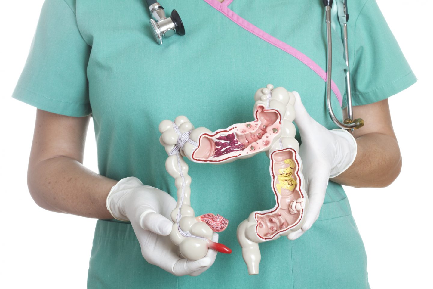 showing appendicitis
