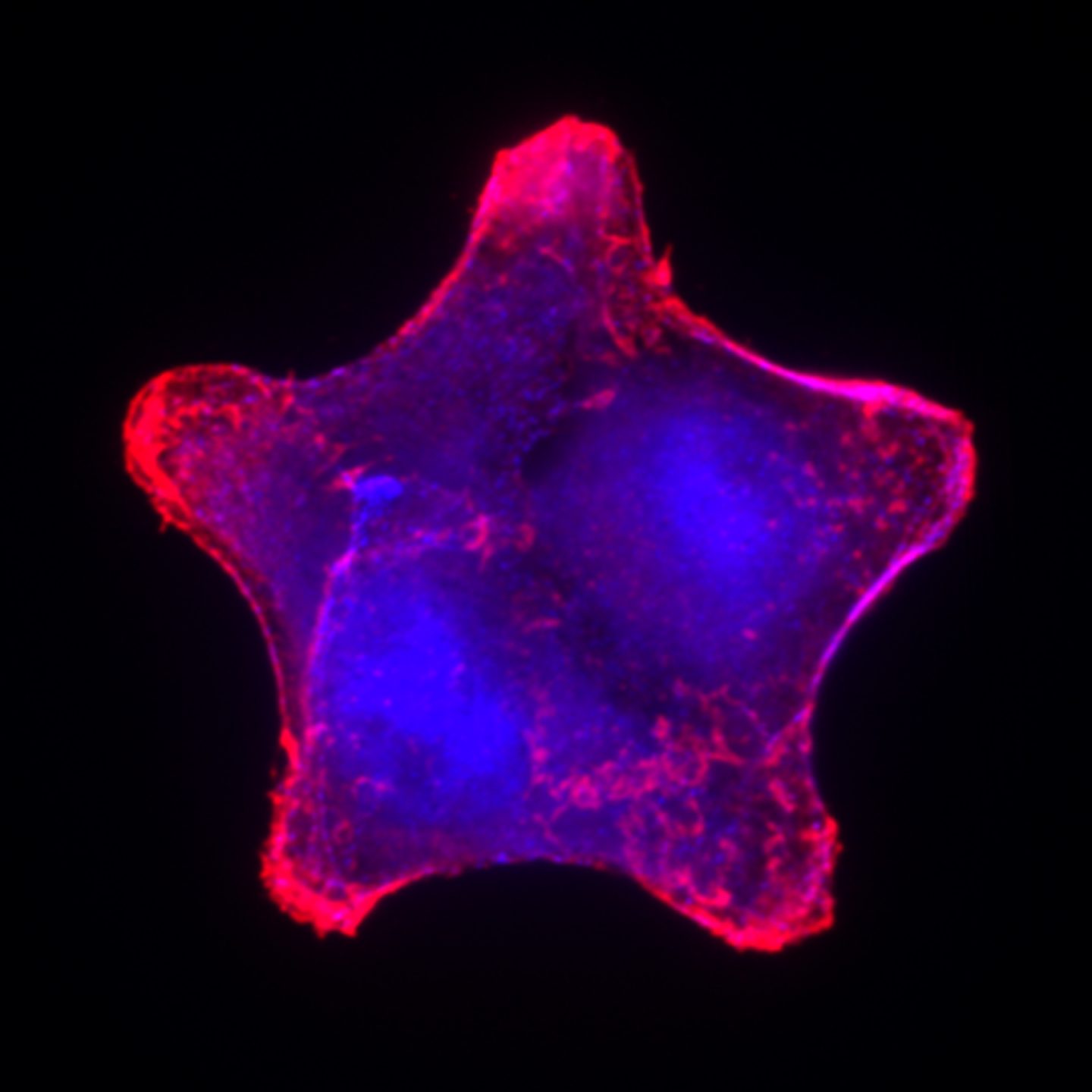A metastatic cancer cell induced to grow into a star shape.