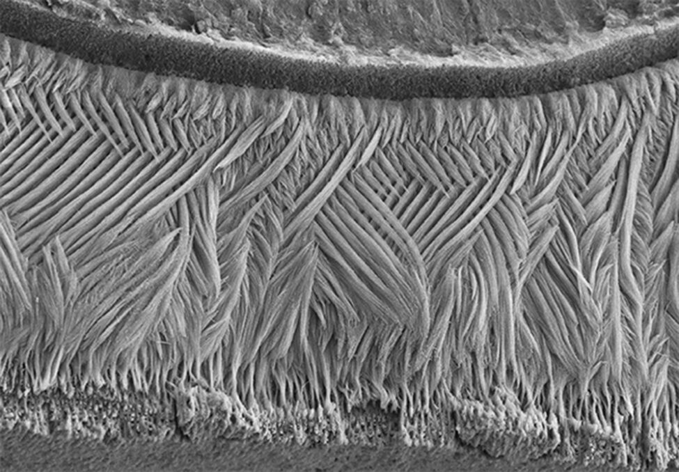 A scanning electron micrograph of the enamel in a mouse’s tooth.