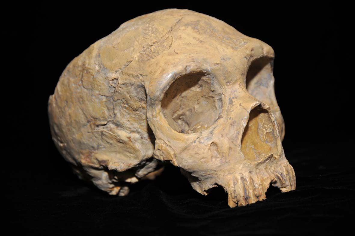showing teeth that could yield surprising clues about diet and medication.