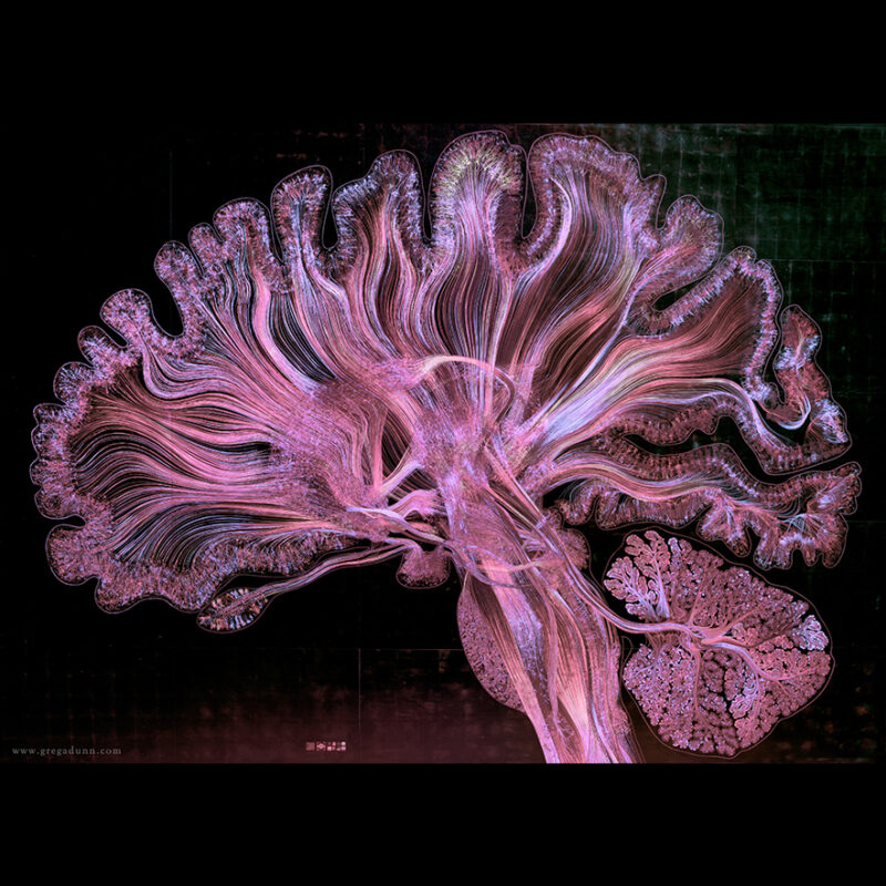 A Striking New Vision Of The Human Brain Cosmos Magazine