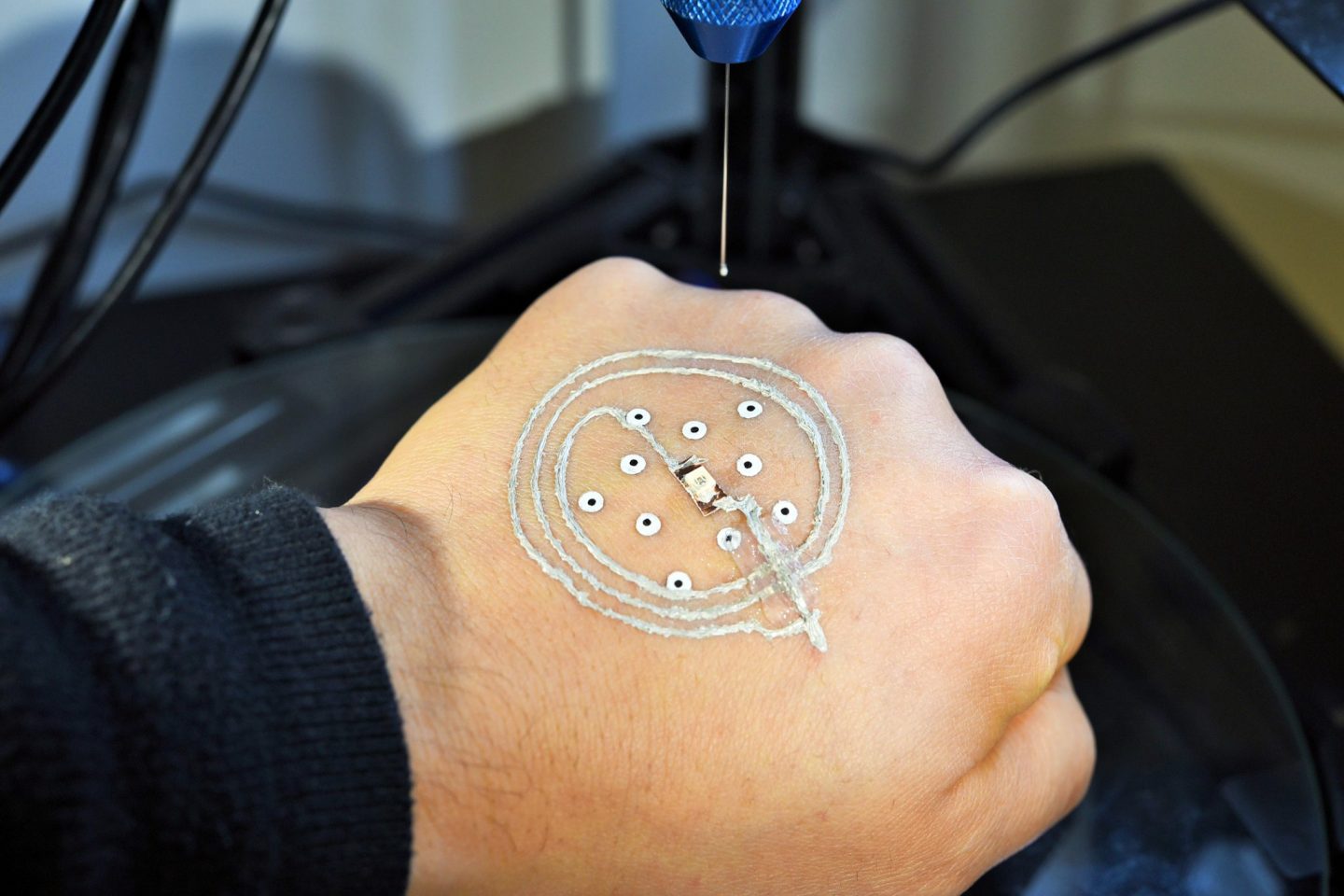 A new technique can print circuits and biological cells directly onto skin.
