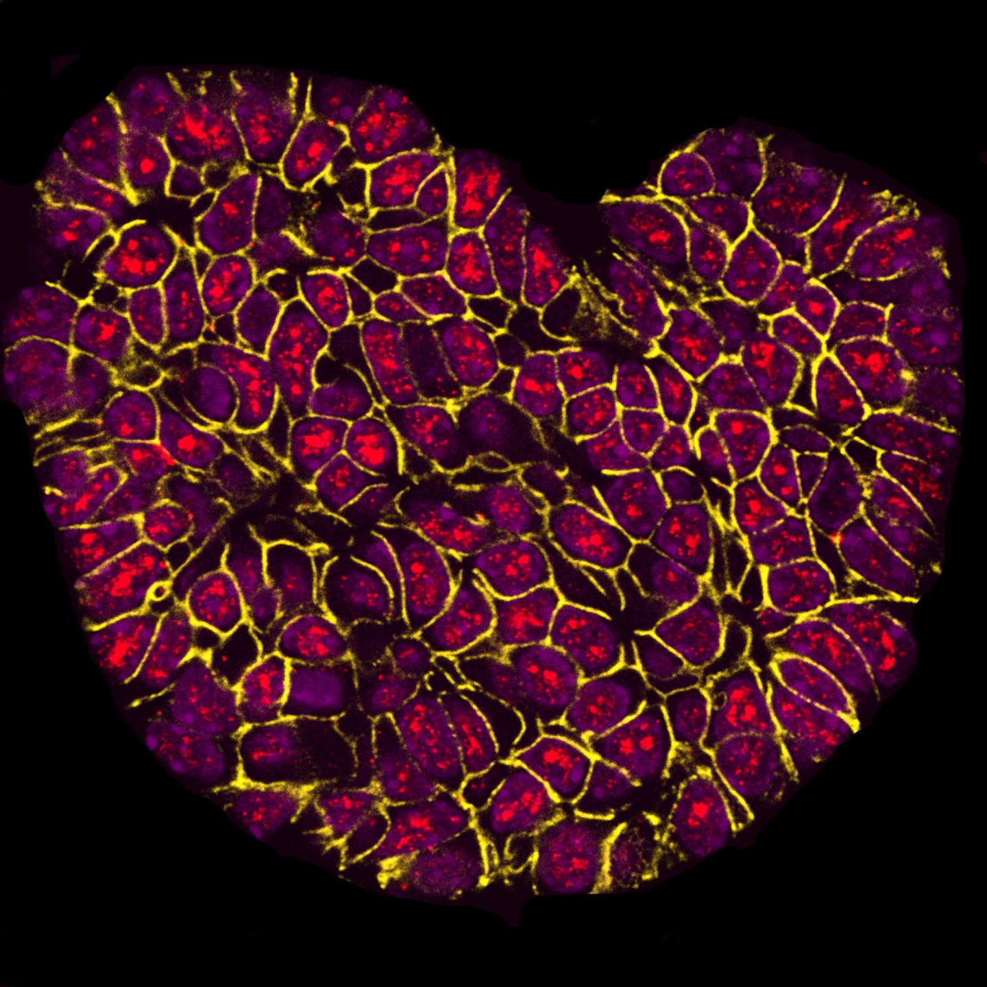 'I Heart Research': First prize winner in the BMC Research in Progress Photo Competition