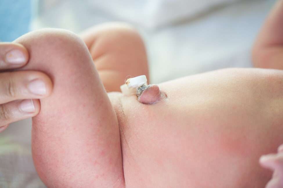 a newborn baby's belly button