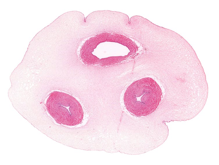 Cross section of the umbilical cord source of the belly button