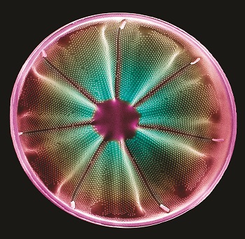Actinocylcus sp. Diatom cr steve gschmeissner