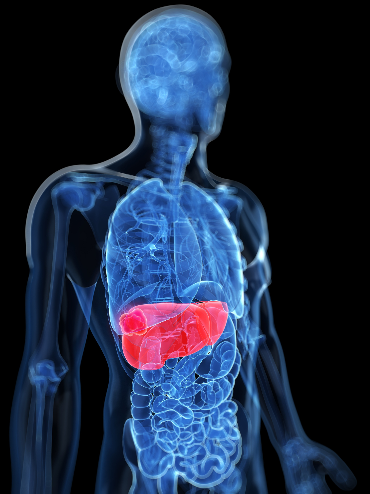 Fat fuels liver cancer cells - Cosmos Magazine