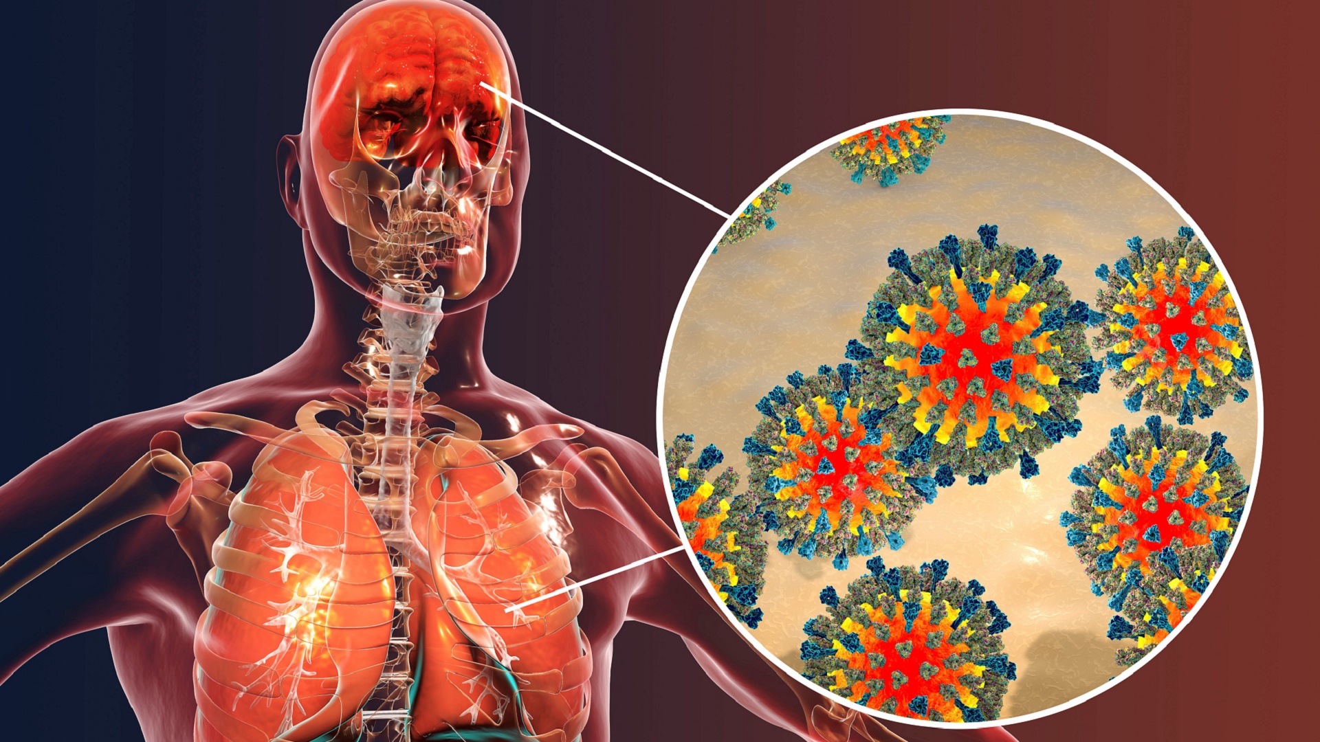 how-measles-impacts-your-immune-system