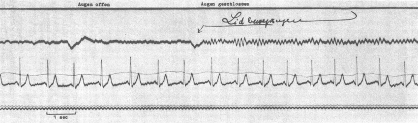201121 EEG registration