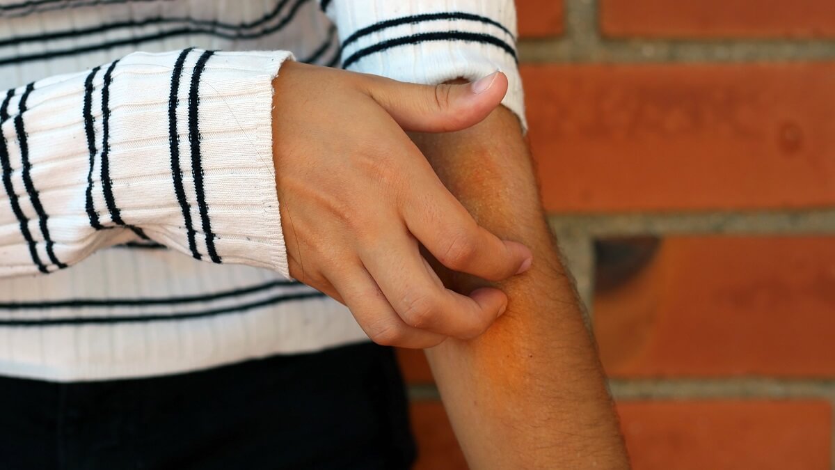 A hand scratching an arm.
