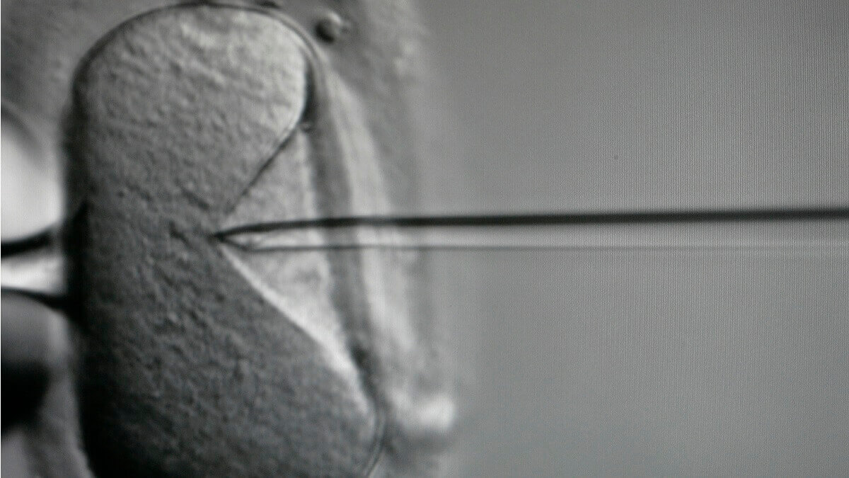 A needle being used in ICSI. ICSI is often used in IVF procedures, even though it may not be necessary.