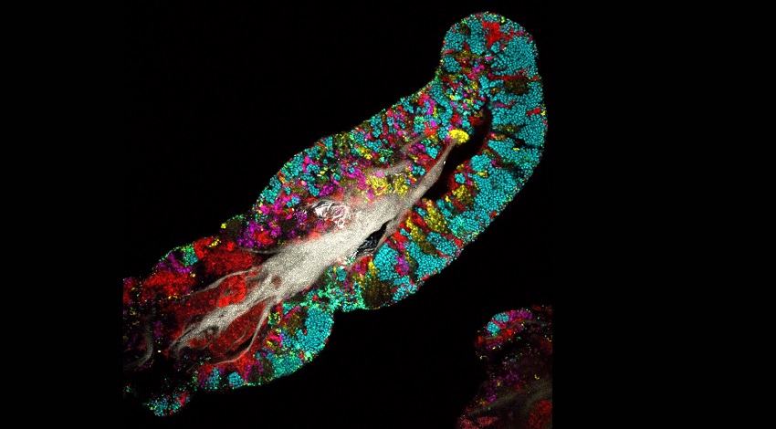 Microbes on a tongue.