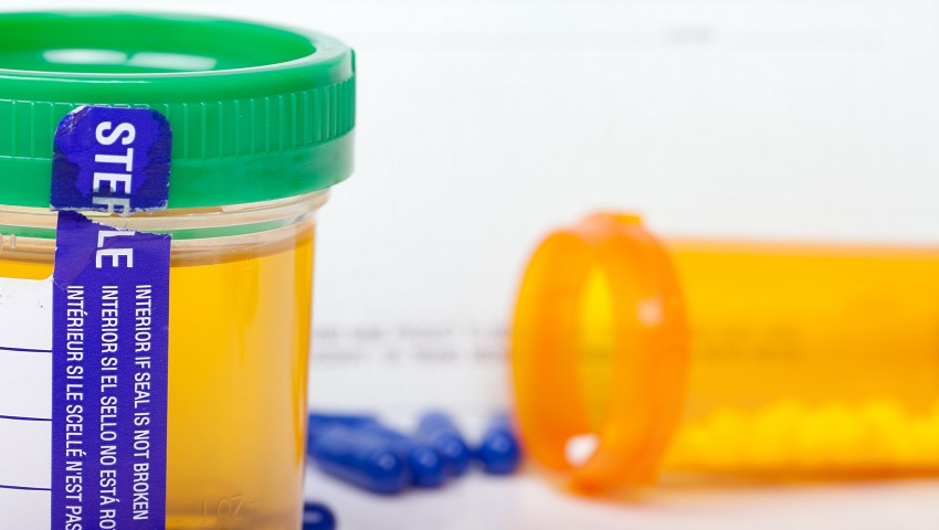 urine in a flask and generic pills