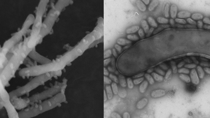 Image of miscoropic parasite under electron scanning microscope.