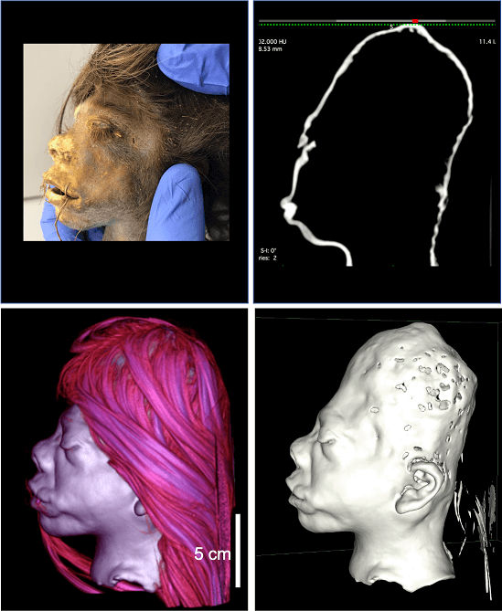 Four images. One is a photo of a small head. On is an outline of the head. One is a pink 3d image of the head. One is a hairless ct scan of the head.