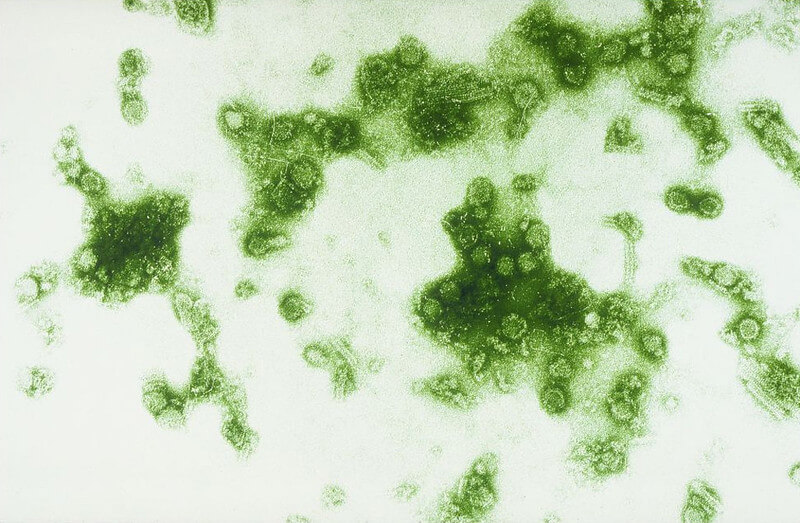 Dengue virus flavivirus seen under an elect… flickr