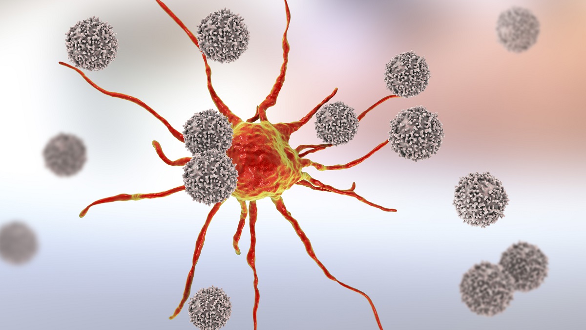T lymphocyte cells attacking a cancer cell, computer illustration. T lymphocytes are a type of white blood cell that recognise a specific site (antigen) on the surface of cancer cells or pathogens and bind to it. Some T lymphocytes then signal for other immune system cells to eliminate the cell. The genetic changes that cause a cell to become cancerous lead to the presentation of tumour antigens on the cell's surface.