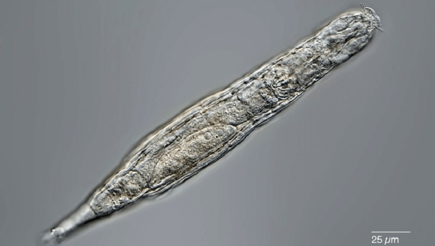 A long-worm like creature on a grey background. There is a small scale bar that says 25 micrometres.