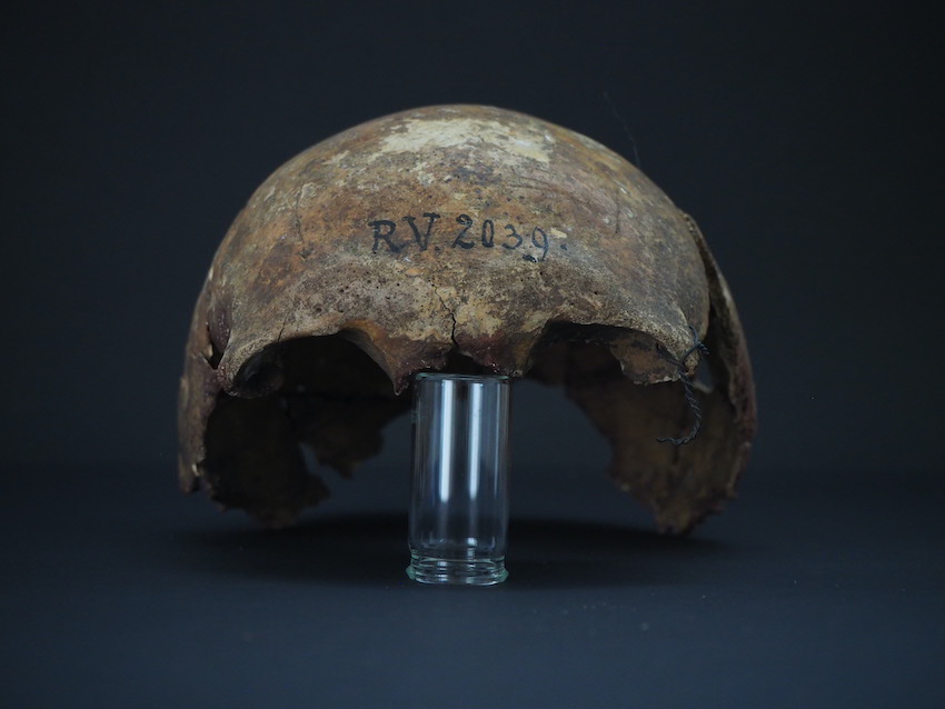 Skull bones of the man buried in riukalns latvia around 5000 years ago 1 credit dominik goldner bgaeu berlin