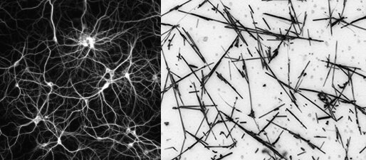 Right - whire neurons. Left black fibres