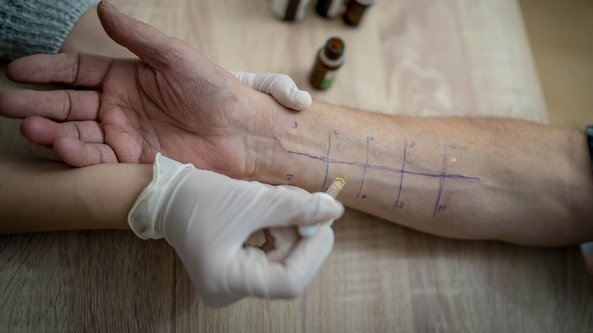 An arm with a grid drawn on it. hand in a glove is putting a swab on the arm