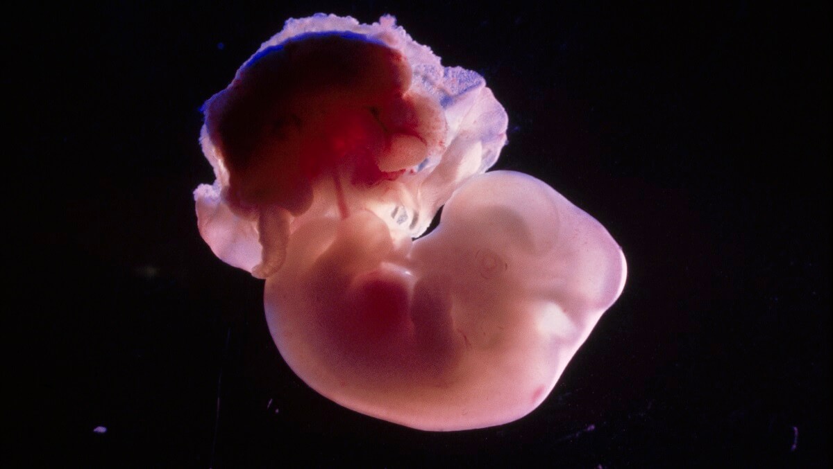 small, barely developed embryo attached to a placenta. they are almost the same size with the embryo is slighly bigger