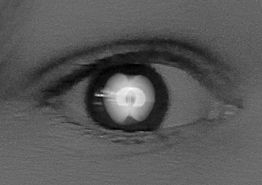 X-ray of an apple superimposed on black and white photo of an eye