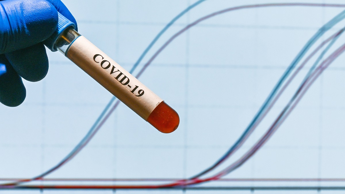 PCR diagnostics COVID-19. A test tube with a sample against the background of REAL-TIME PCR amplification curves.
