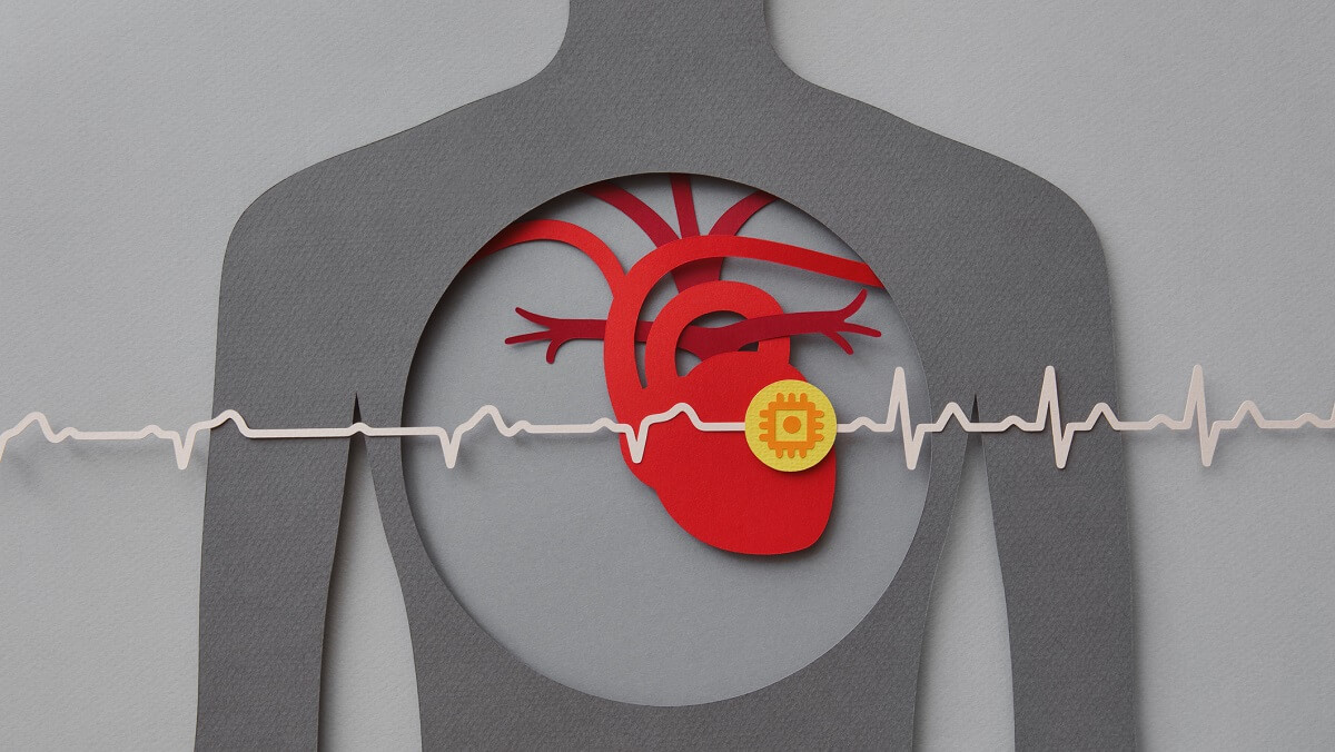a scematic of a heart inside a torso with a 'heartbeat' line above it